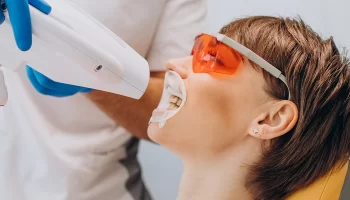 Interesting Facts About Teeth Whitening