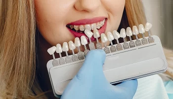Dental Veneers: What You Need to Know Before Getting Them