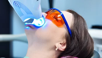 Teeth Whitening at Dentist: Everything You Need to Know