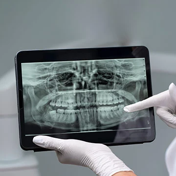 Digital_X-rays
